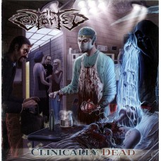 Компакт - диск CONTORTED - CLINICALLY DEAD CD